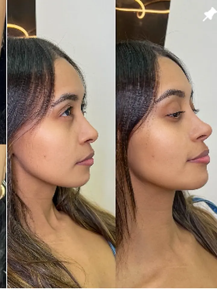 Harmonização de perfil