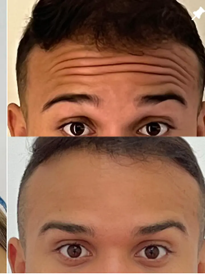 Suavização de linhas