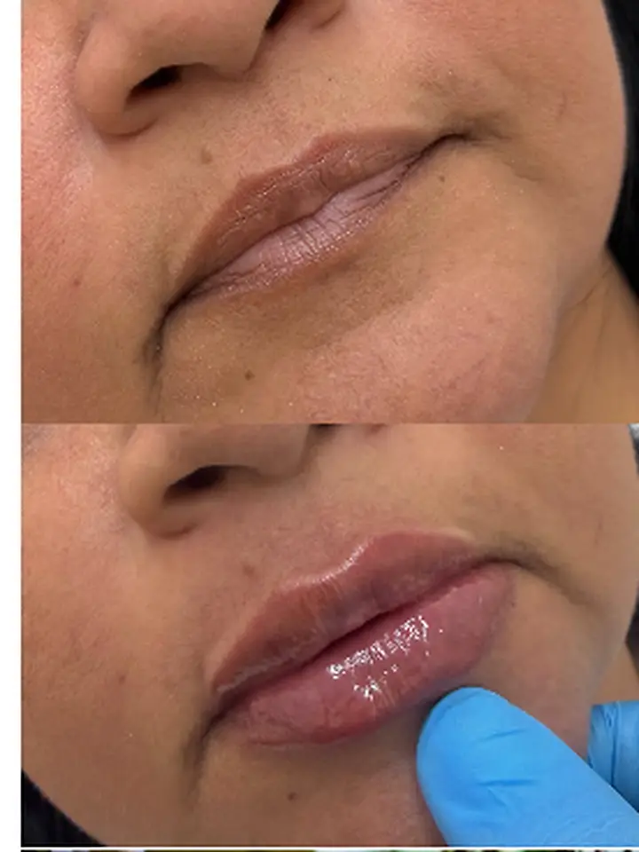 Contorno labial