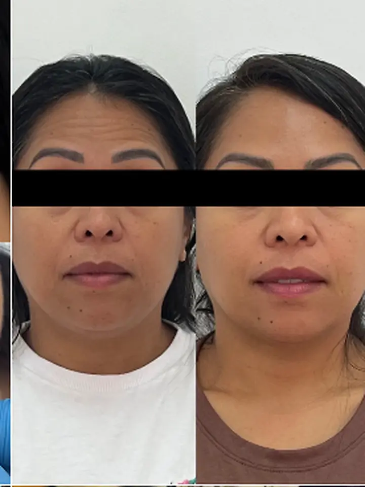 Equilíbrio facial